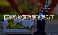 杨幂脸被蒸汽眼罩烫伤了：大家使用时要小心！
